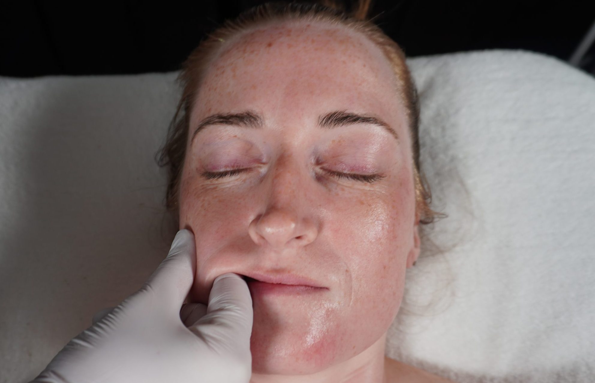 Buccal Facial Massage Goodlettsville TN
