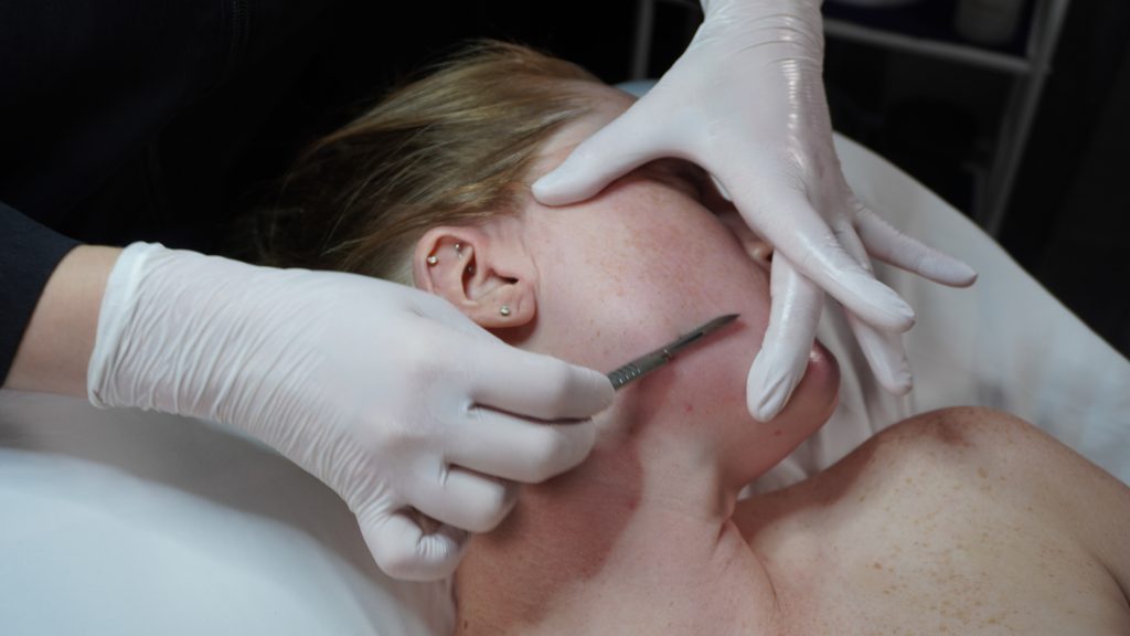 Skin Care Services Consultation Modern Skin Science Goodlettsville, TN